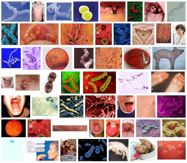 Streptokokken (und Wie Man Sich Vor Einer Ansteckung Schützt)